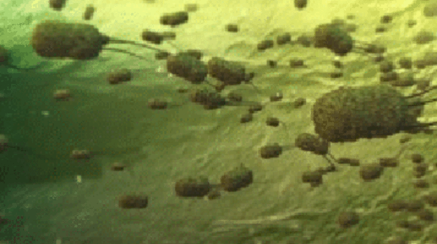 Leblebi Gibi Hap İçenler Bu Korkunç Haber Sizin Eseriniz:Tüm Antibiyotiklere Dirençli Bakteri Dehşet Saçacak!