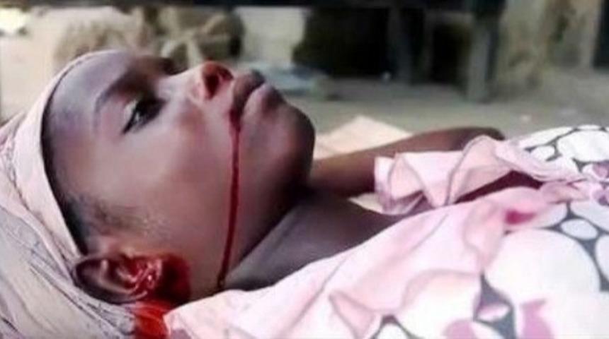 Dünyadaki En Tehlikeli Virüslerinin Başında Gelen Ebola Hakkında Bilmeniz Gereken 22 Gerçek