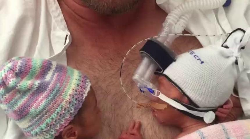 El Ele Tutuşan 28 Haftalık Doğan Prematüre İkizler Kalbinizi Eritecek 