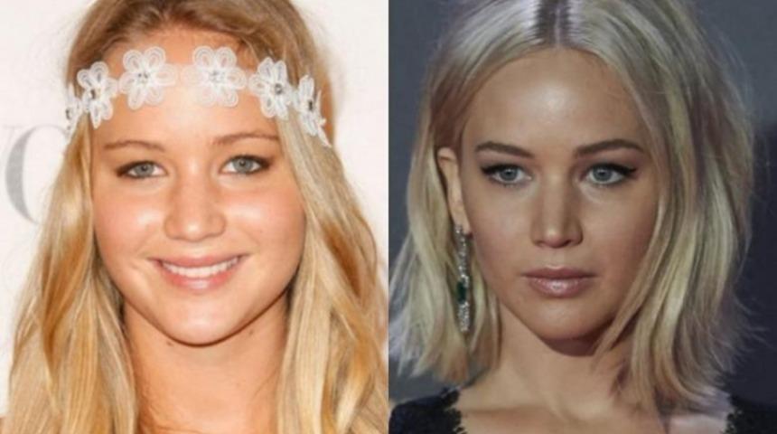 Burun estetiği yaptırıp g&uuml;zelliklerine &ccedil;arpı iki ekleyen 17 &uuml;nl&uuml;