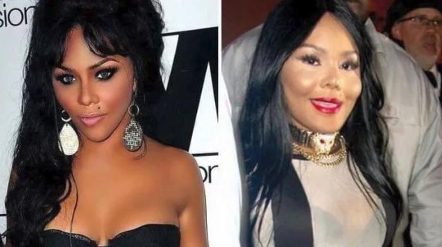 &Ouml;ncesi ve sonrasıyla estetik kurbanı &uuml;nl&uuml;ler