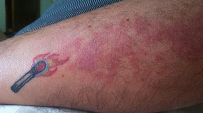 Yara izlerini, yaptırdıkları dövmelerle sanat eserine çevirmiş 20 kişi!