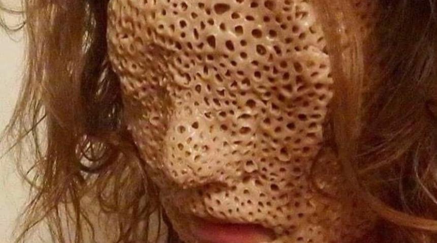 Allah düşmanımın başına vermesin dedirten fobi: Tripofobi