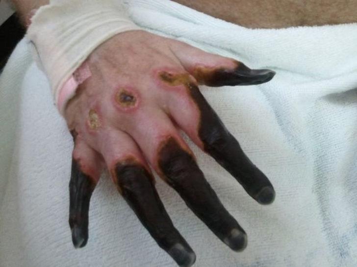 Avladığı sincabın beynini yedi, sonu oldu! G3