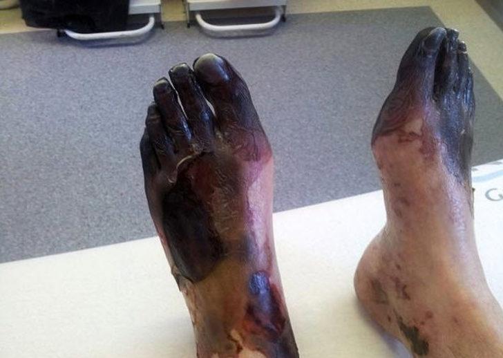 Avladığı sincabın beynini yedi, sonu oldu! G4