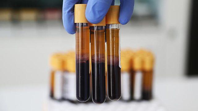 MCH nedir? MCH normal değeri nedir? MCH düşüklüğü ve yüksekliği ne anlama gelir? 