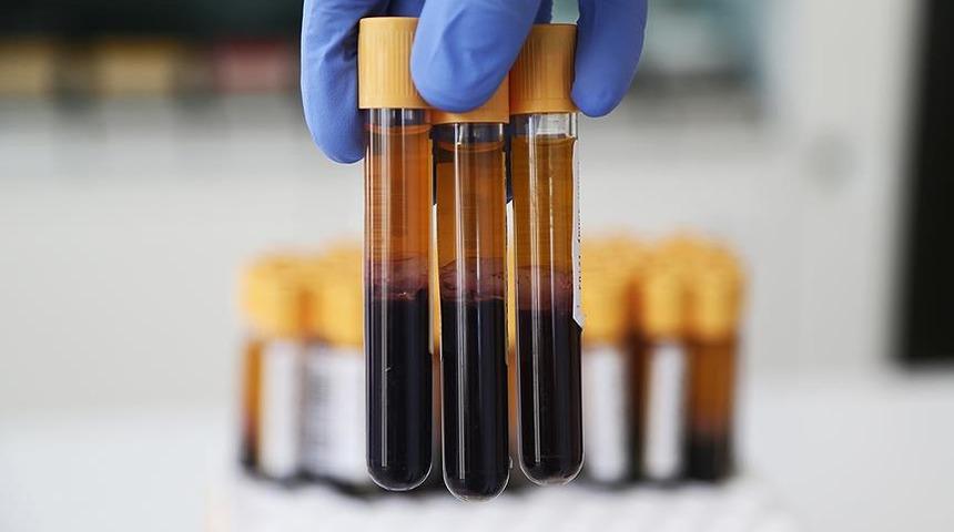 MCH nedir? MCH normal değeri nedir? MCH düşüklüğü ve yüksekliği ne anlama gelir? 