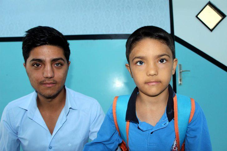 İki kardeş göz renkleriyle görenleri şaşırtıyor  G1