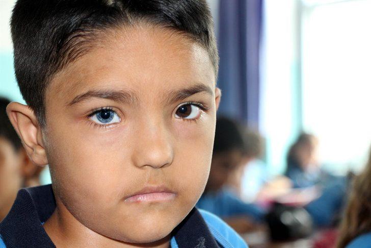 İki kardeş göz renkleriyle görenleri şaşırtıyor  G5