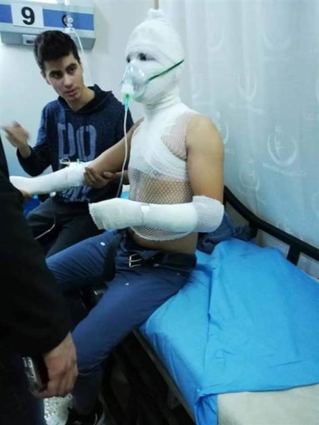 Lise &ouml;ğrencilerinin evdeki deneylerinin sonu korkun&ccedil; oldu!