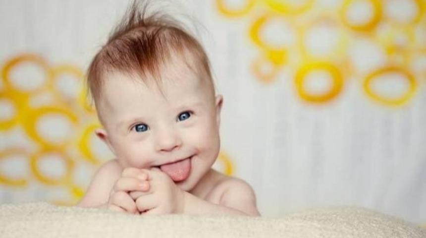 Çocuğunuzun Engelli Doğacağını Bilseniz Ne Yapardınız?