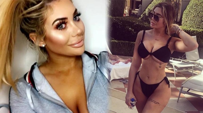 Geçirdiği estetik ameliyatlardan sonra vücut dismorfik bozukluğu olduğunu itiraf etti!