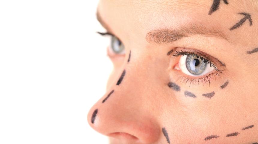 Y&uuml;z gerdirme: Sorular ve cevapları