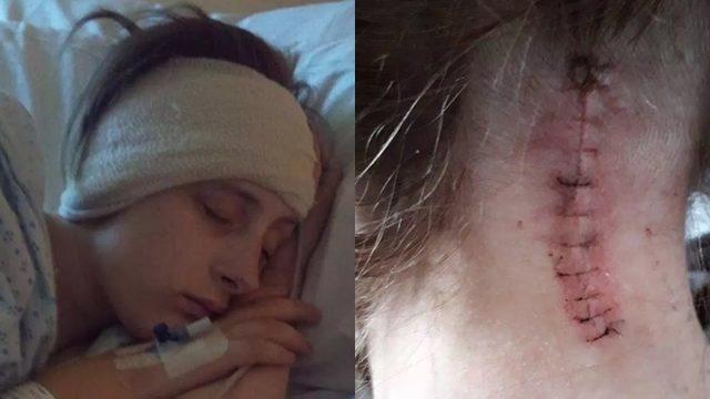 Baş ağrısı deyip geçmeyin! Migreni var sanıyordu beyinciği sarktı!