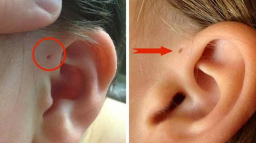 Kulağınızın &uuml;zerindeki o delik ne acaba?