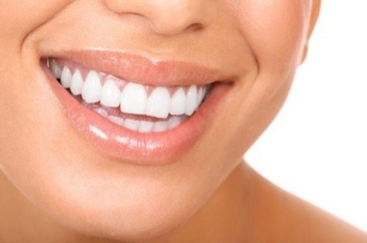 Diş beyazlatma sağlıksız olabilir mi?