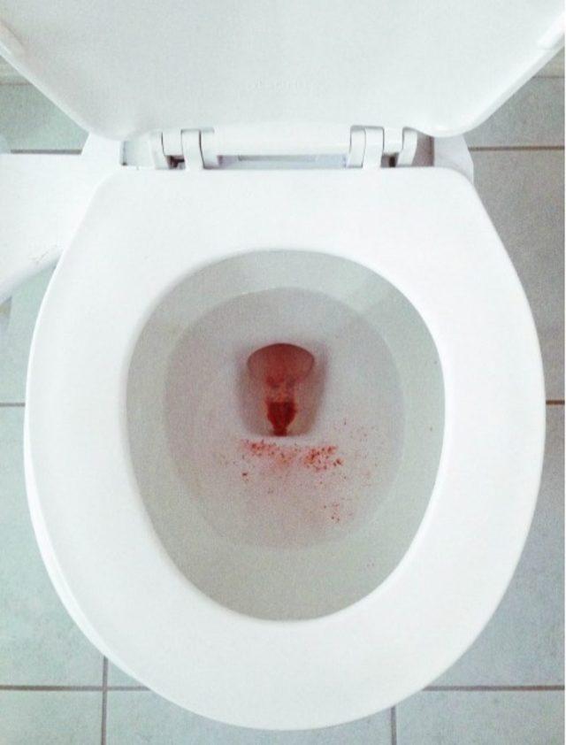 Regl D&ouml;neminde Kanlı Fotoğrafını Instagram a Koyan Kadının Savaşı 1