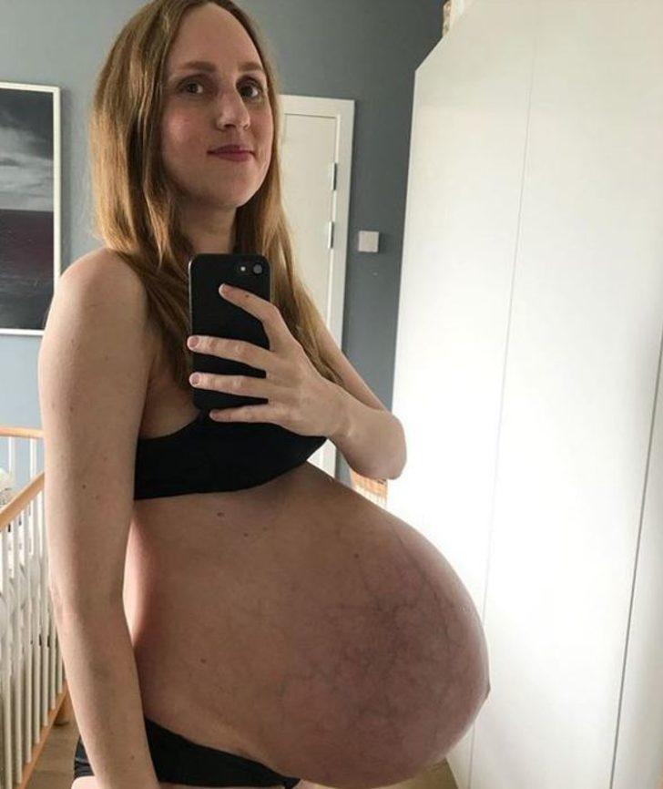 Doğumdan sonra paylaştığı fotoğraf şok etti  G2