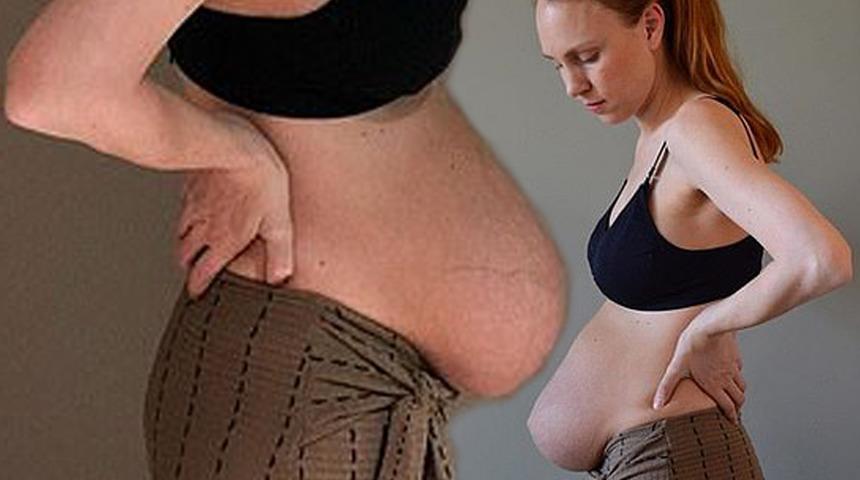 Tabuyu yıkmak istiyor! '&Uuml;nl&uuml;lerin fotoğraflarına inanmayın doğum sonrası ger&ccedil;ek bu'