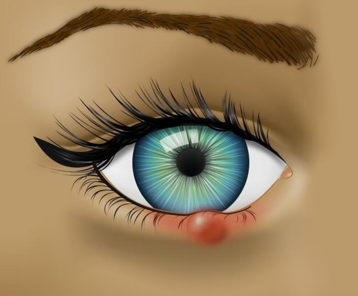 Gözlerinizin Sağlığınızla İlgili Söylemeye Çalıştığı 8 Şey G1