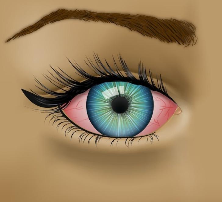 Gözlerinizin Sağlığınızla İlgili Söylemeye Çalıştığı 8 Şey G3