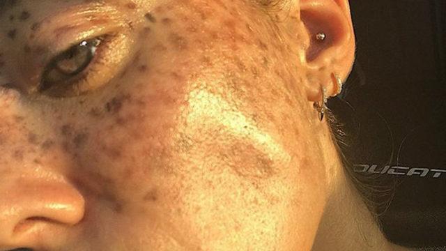  Farklılıkları manken olmalarını engelleyemedi!