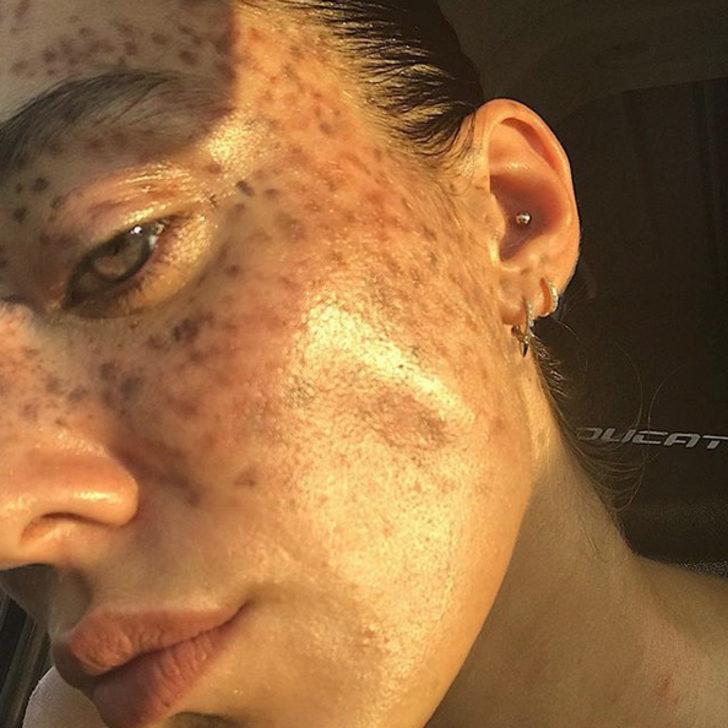 Siyahi manken Nyakim Gatwech hayat hikayesiyle iham ve cesaret aşılıyor G1