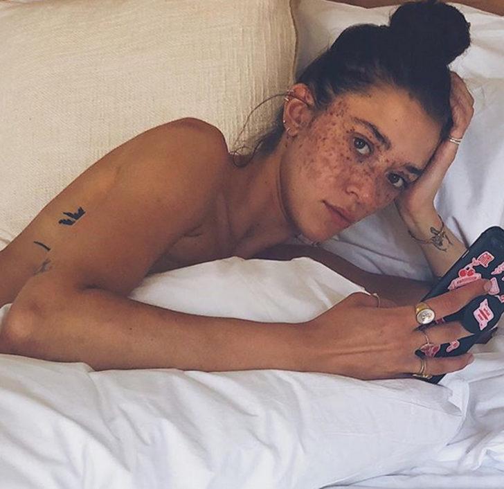 Siyahi manken Nyakim Gatwech hayat hikayesiyle iham ve cesaret aşılıyor G4