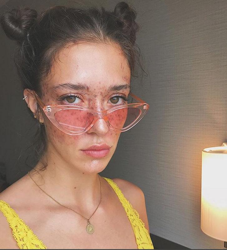 Siyahi manken Nyakim Gatwech hayat hikayesiyle iham ve cesaret aşılıyor G5