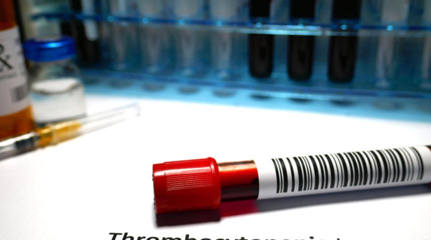 PDW nedir? Kan tahlili PDW neden yükselir? Düşük çıkması ne anlama gelir? 