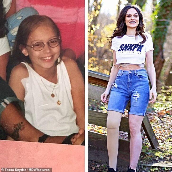 11 yaşında kanser oldu, bacağını aldılar! Şimdi markaların peşinden koştuğu bir model G4