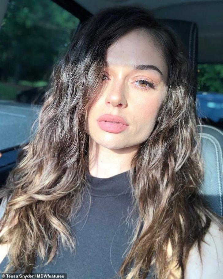 11 yaşında kanser oldu, bacağını aldılar! Şimdi markaların peşinden koştuğu bir model G5