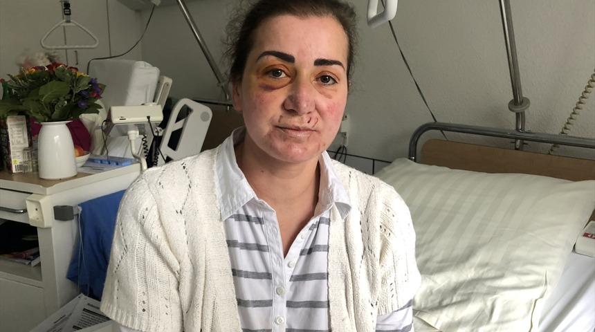 Almanya'da Türk kadına tramvayda saldırı