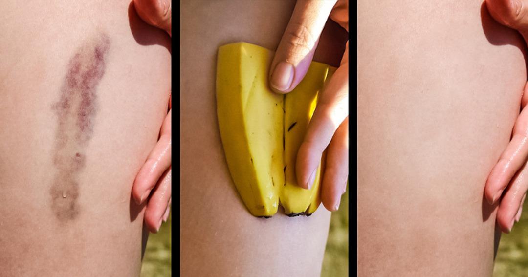 Sağlık sorunlarının &uuml;stesinden gelen 7 gıda