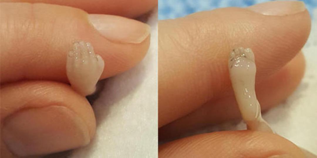 Bu ayaklar 14 haftalık bir erkek bebeğe ait