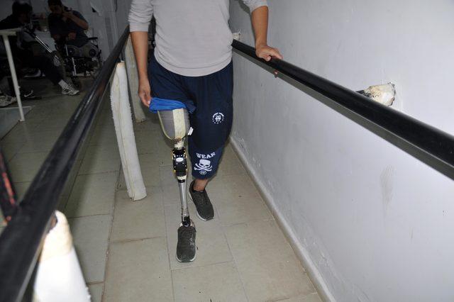 Savaş mağduru Suriyelilere, el ve ayak protezi