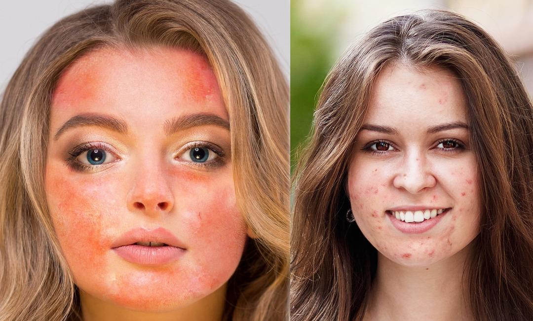 Fayda sağladığını d&uuml;ş&uuml;n&uuml;yorduk ancak bu &uuml;r&uuml;nler cildimize zarar veriyor