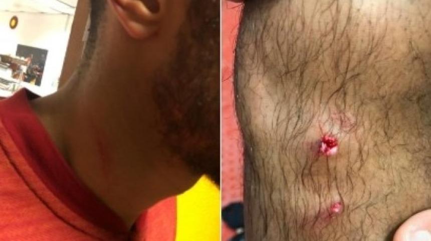 Galatasaray, olaylı derbiden sonra Belhanda ve Garry Rodrigues paylaşımı yaptı!