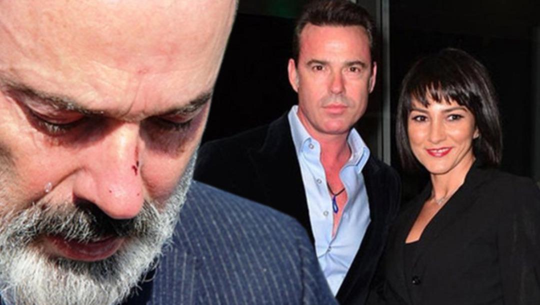 Murat Başoğlu harekete ge&ccedil;ti! 'Yurtdışı yasağımı kaldırın'