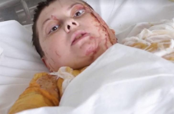 Ukrayna'da asit saldırısına uğrayan aktivist öldü G4