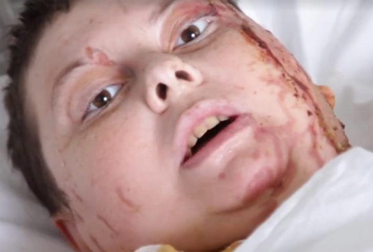 Ukrayna'da asit saldırısına uğrayan aktivist öldü G5