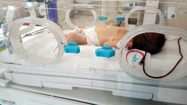 Elazığ'da yenidoğan bebeğe anüs yapıldı