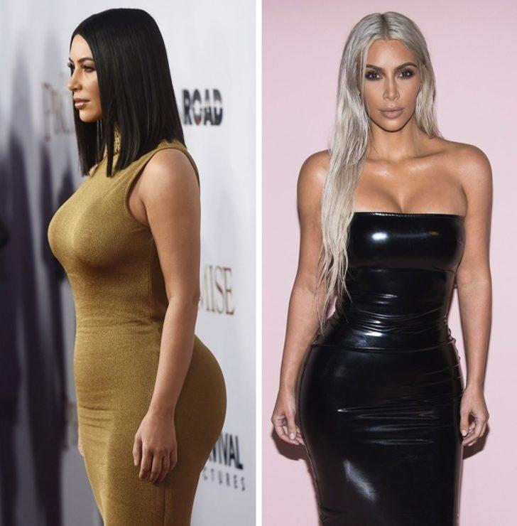 Vücut kusurlarını imajlarının bir parçası olarak gören ünlüler! Kadınlara güven aşılıyorlar G4
