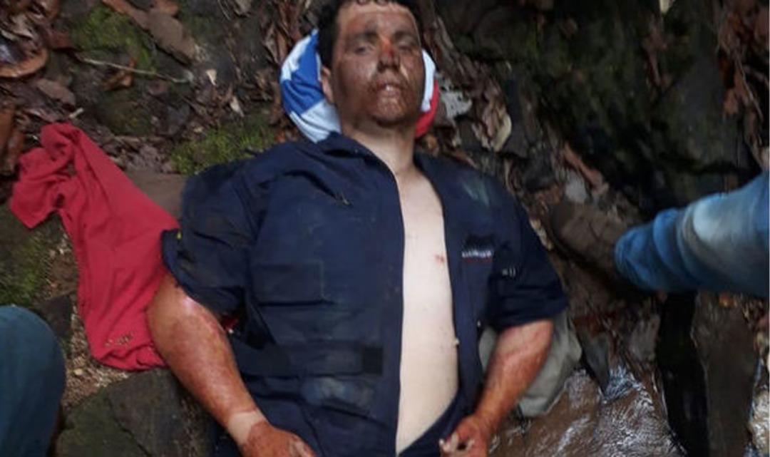 Ormanda bu halde bulundu! Şoke eden anlar