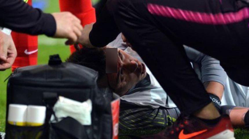 Muslera, Kayserispor ma&ccedil;ında kanlar i&ccedil;inde yerde kaldı!